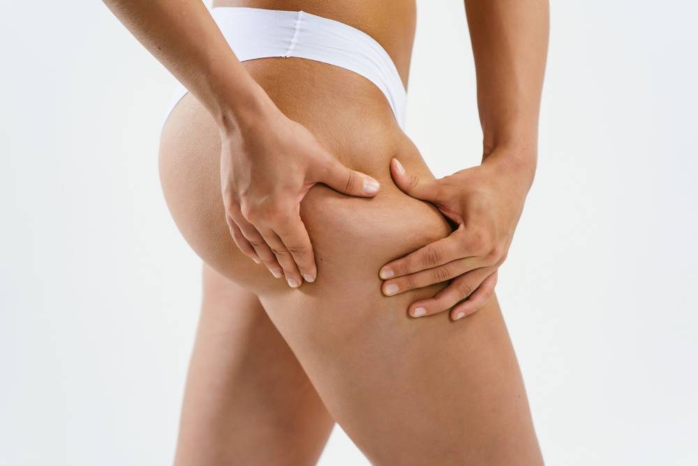 La cellulite mémo - Le Havre